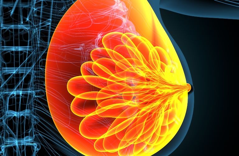 Sacituzumab govitecan gains EU approval for HR+/HER2- breast cancer