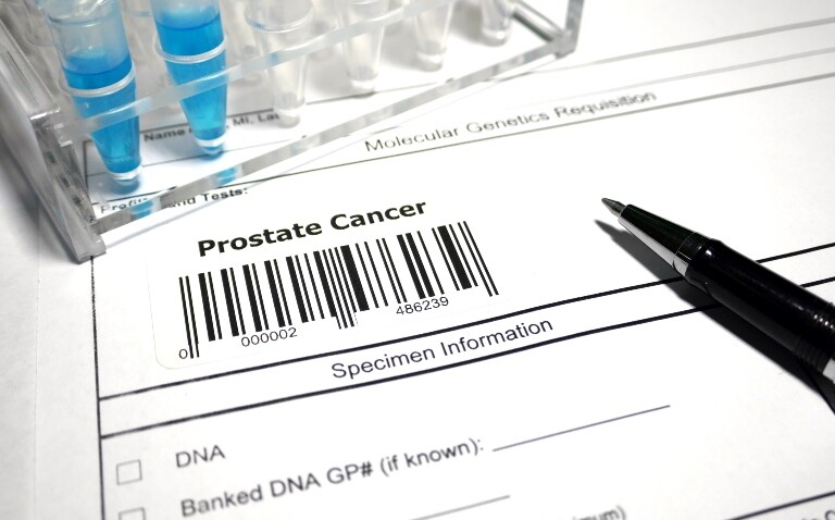 A specimen information form labelled 'Prostate Cancer' with barcode and sample vials to illustrate that a saliva test has been found to be more accurate than PSA or MRI for prostate cancer risk