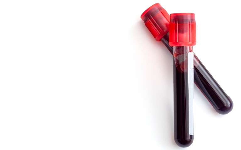Two vials of blood for testing to illustrate an innovative opt-out blood-borne virus testing service at Nottingham University Hospitals NHS Trust