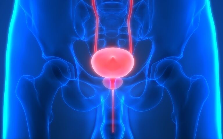 Stereotactic radiotherapy equivalent to standard care in localised prostate cancer