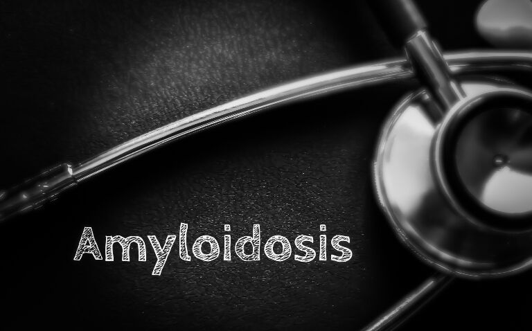 Tafamidis now available on the NHS as first approved treatment for ATTR-CM