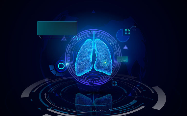 Tailoring diagnosis and treatment pathways for complex lung disease