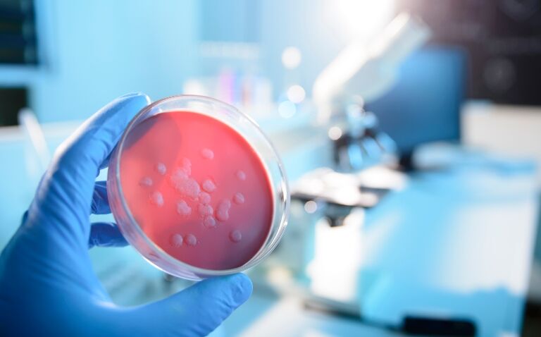 The view from ESCMID Global 2024: AI