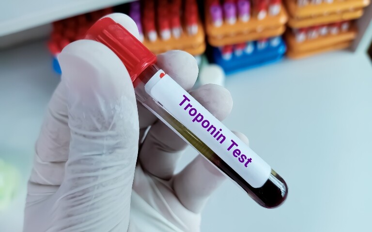 A white-gloved hand holding a test tube of blood with Troponin Test written on it in red lettering and racks of test tubes in the background to illustrate troponin tests being a powerful indicator of cardiovascular risk