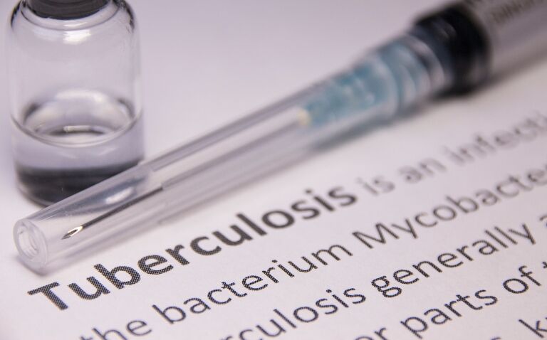 Tuberculosis rates unnecessarily rising globally