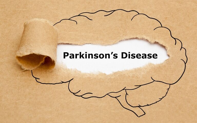 Type 2 diabetes drug lixisenatide shows potential in slowing Parkinson’s disease progression