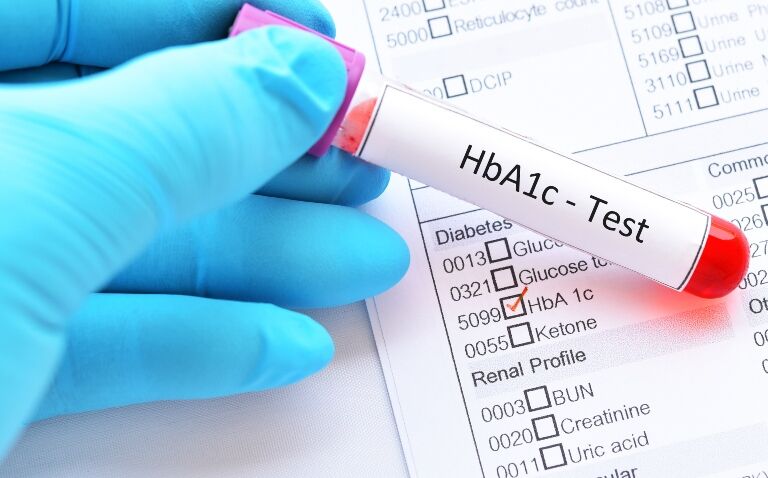 Type 2 diabetes remission associated with reduction of CVD and CKD complications