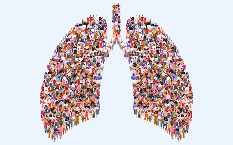 Update lung transplantation guidelines due to unfounded gender differences
