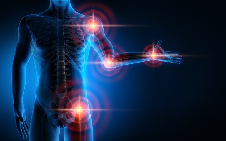 A digital illustration of a human body with pain points over the shoulder
