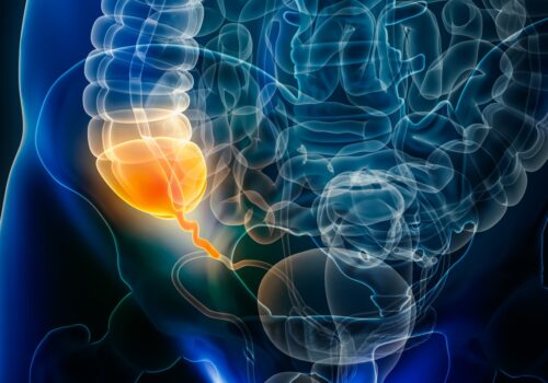 A digital illustration of a transparent human body with the gastrointestinal system visible and the appendix highlighted in orange to illustrate WSES acute appendicitis and updated international guidelines for its diagnosis and management