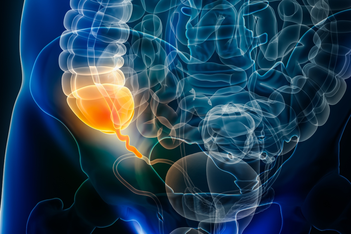 A digital illustration of a transparent human body with the gastrointestinal system visible and the appendix highlighted in orange to illustrate WSES acute appendicitis and updated international guidelines for its diagnosis and management