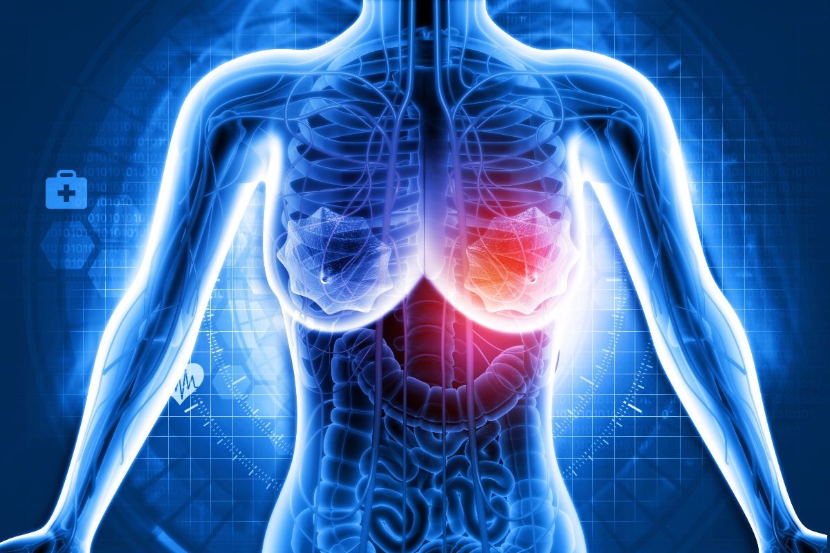 Medical illustration of a female upper body with visible internal organs