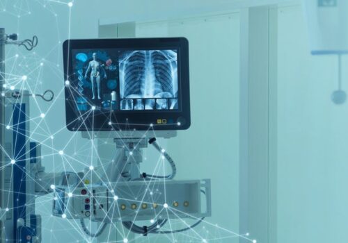 AI assistance improved X-ray fracture detection with no increase in reading time