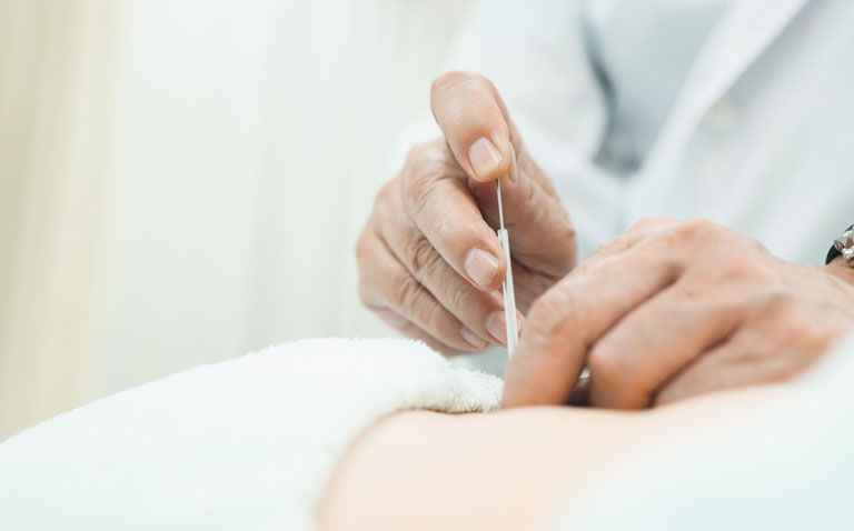 Acupuncture with diclofenac provides substantial and fast pain relief in renal colic