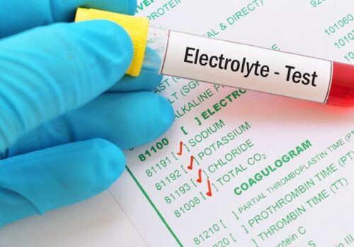 Acute COPD exacerbation in ED commonly associated with unharmful dysnatraemia and dyskalemia