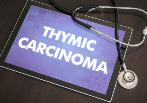 Apatinib therapy promising for thymic epithelial tumours