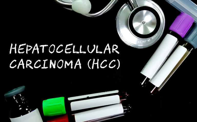 Atezolizumab anti-drug antibodies worsen survival in hepatocellular carcinoma