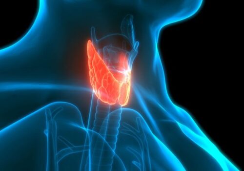 Autoimmune thyroiditis in children associated with thyroid cancer