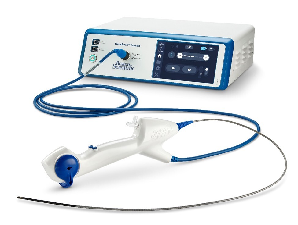 What is ureteroscopy and how does it help in treating kidney stones?