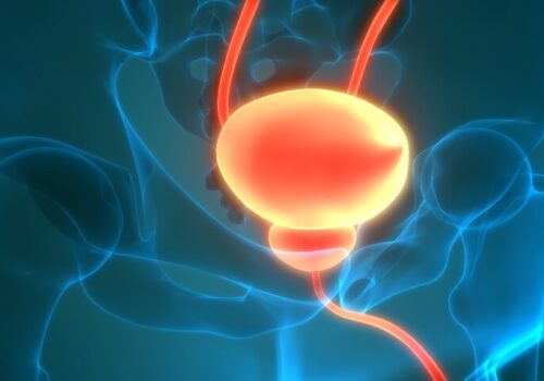 A digital illustration of a pelvis with the bladder and prostate highlighted in red to illustrate the finding that baseline PSA levels are linked to long-term prostate cancer risk