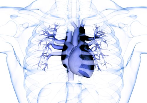Transparent anatomical illustration of the human chest showing the heart and surrounding blood vessels in blue, with visible ribs and lungs to illustrate the finding that bleeding risk after LAAO high but largely driven by patient factors