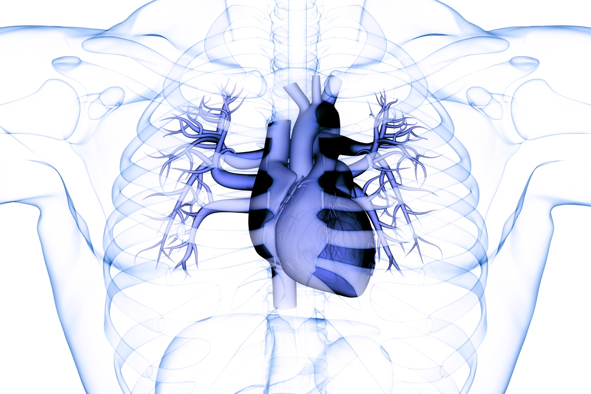 Transparent anatomical illustration of the human chest showing the heart and surrounding blood vessels in blue, with visible ribs and lungs to illustrate the finding that bleeding risk after LAAO high but largely driven by patient factors