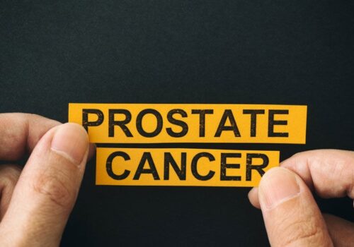 Caffeine genotype linked to better prostate cancer survival