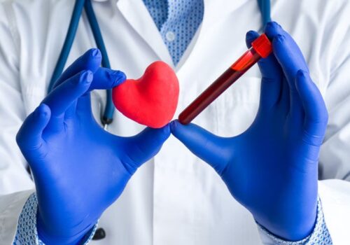 Cardiac biomarkers associated with higher risk of cardiovascular events in psoriasis disease