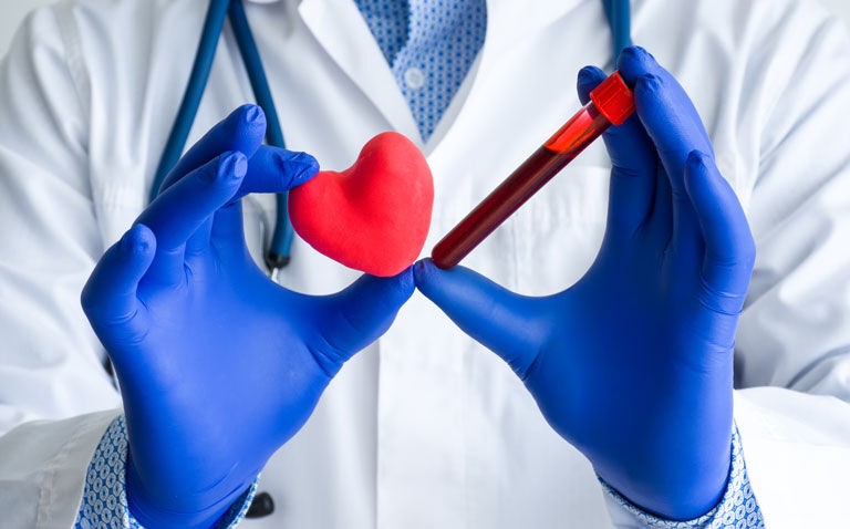 Cardiac biomarkers associated with higher risk of cardiovascular events in psoriasis disease