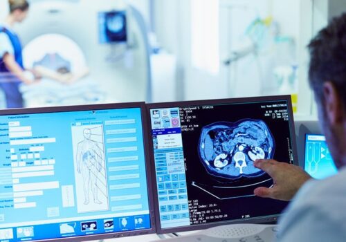 Contrast agent pooling on CT scan predictive of imminent cardiac arrest