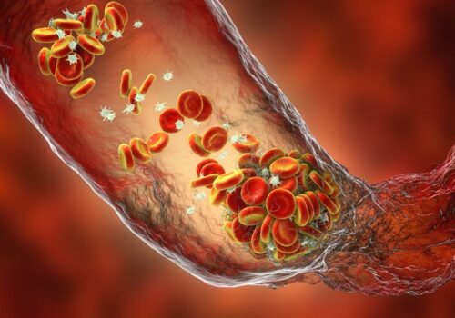 DOACs superior to prophylactic doses of heparins for thromboprophylaxis in non-cardiac surgery