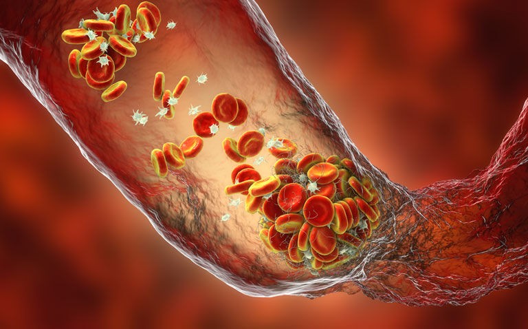 DOACs superior to prophylactic doses of heparins for thromboprophylaxis in non-cardiac surgery