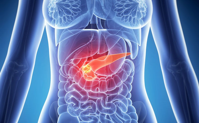 Deep learning-based tool detects pancreatic cancers missed on abdominal CT scan