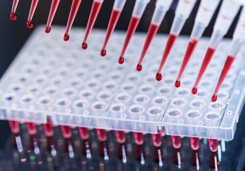 Digital PCR effective for pathogen identification in sepsis