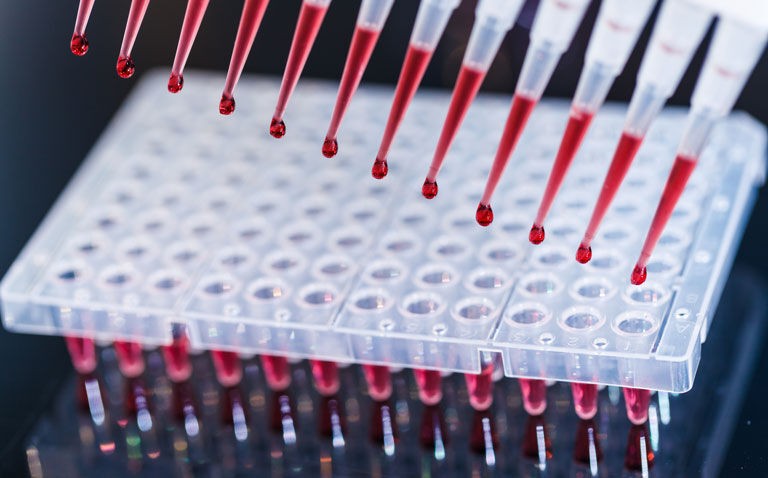 Digital PCR effective for pathogen identification in sepsis