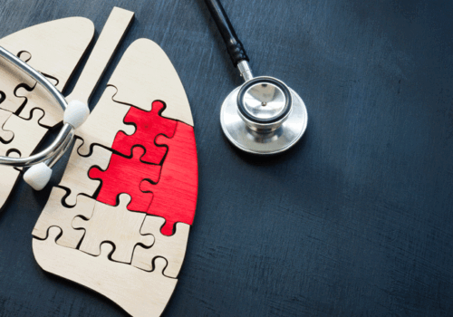 Digital tumour infiltrating lymphocyte scoring predicts ICI benefit in lung cancer