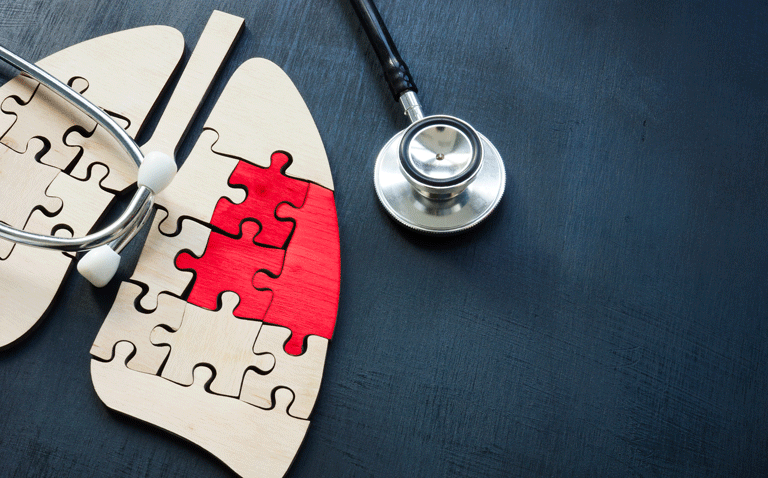 Digital tumour infiltrating lymphocyte scoring predicts ICI benefit in lung cancer