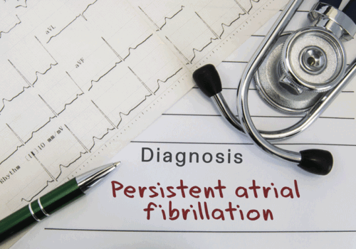 ECG and radiomics model enhances detection of AF in women