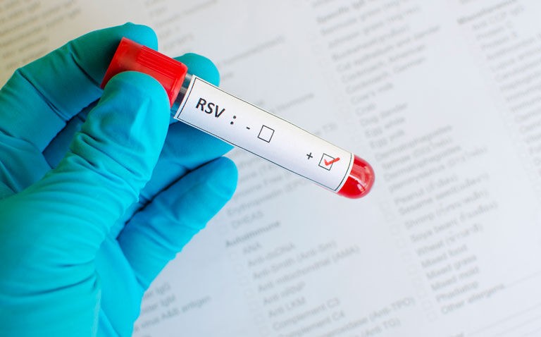 EMA recommends nirsevimab to protect infants from RSV