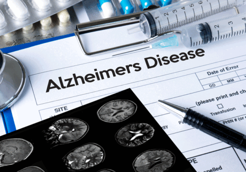Early Alzheimer's disease cognitive decline slowed by lecanemab