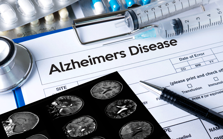 Early Alzheimer's disease cognitive decline slowed by lecanemab
