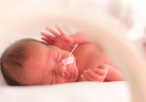 A close up of a preterm infant in a neonatal cot with a feeding tube in their nose to illustrate that early enteral feeding does not increase the risk of necrotising enterocolitis but neonatal admission unaffected