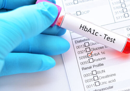 Early glycaemic control in type 2 diabetes reduces subsequent adverse CV outcomes