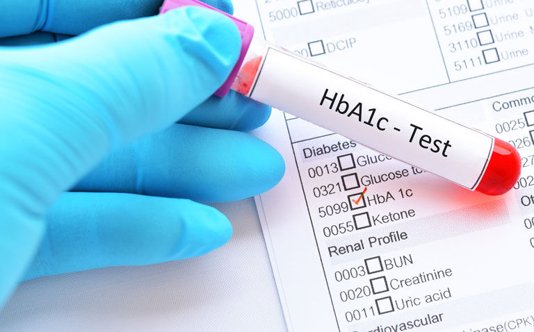 Early glycaemic control in type 2 diabetes reduces subsequent adverse CV outcomes