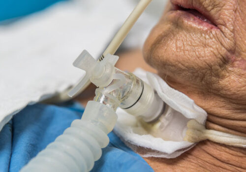Early tracheostomy improves mortality outcomes in critically ill patients