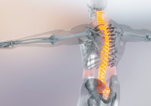 Transparent human figure with arms outstretched showing the skeletal system, with the spine highlighted in bright yellow and the lower back glowing red, indicating spinal pain or inflammation to illustrate the finding that upadacitinib delivers rapid and sustained pain relief across axSpA spectrum
