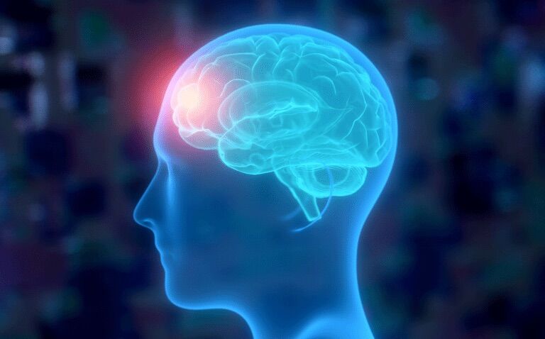 Enlarged perivascular spaces revealed by MRI in migraine sufferers|Enlarged perivascular spaces revealed by MRI in migraine sufferers