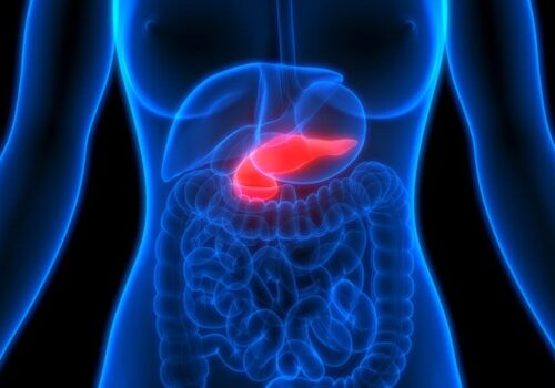Faecal microbiota signature useful screening tool for pancreatic adenocarcinoma