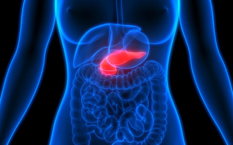 Faecal microbiota signature useful screening tool for pancreatic adenocarcinoma