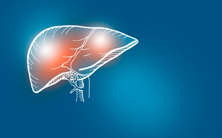 Faecal-microbiota-transplantation-beneficial-in-advanced-cirrhosis|Faecal microbiota transplantation beneficial in advanced cirrhosis